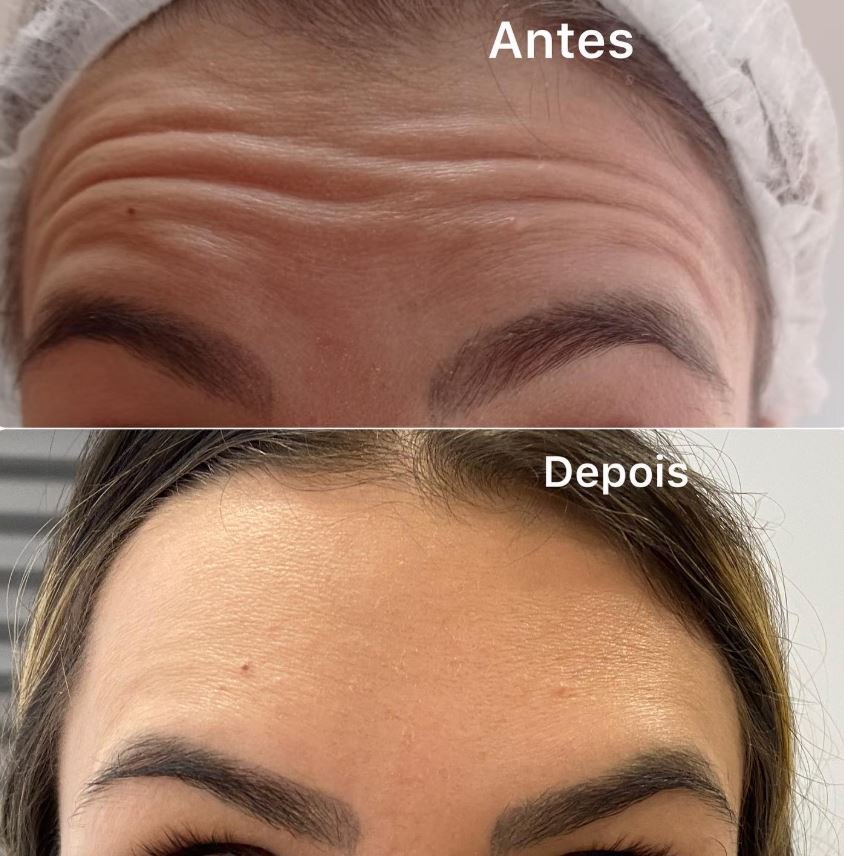 Registro visual de antes e depois de procedimento estético — imagem 1