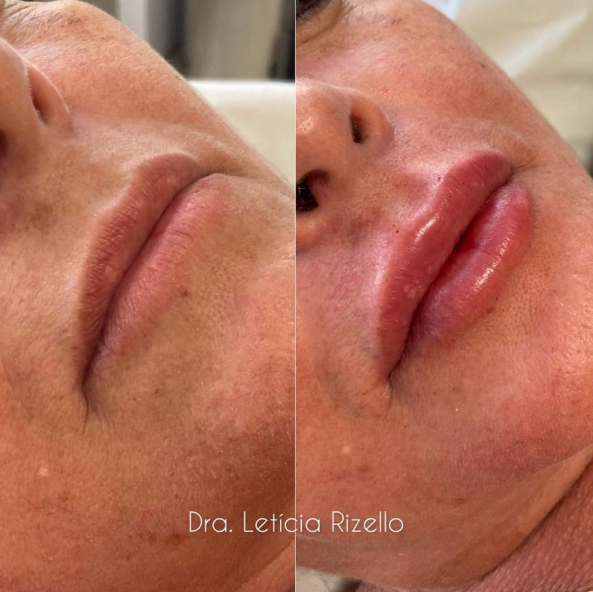Registro visual de antes e depois de procedimento estético — imagem 2