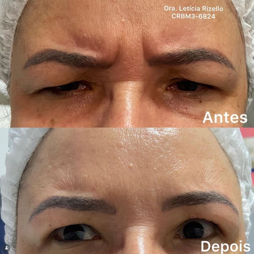 Registro visual de antes e depois de procedimento estético — imagem 3